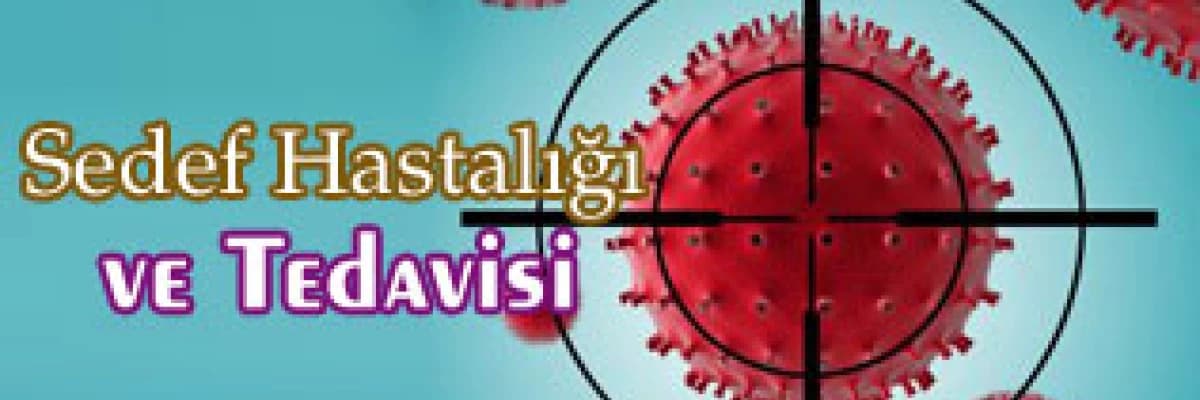 Sedef hastalığı (psoriazis) ve tedavisi