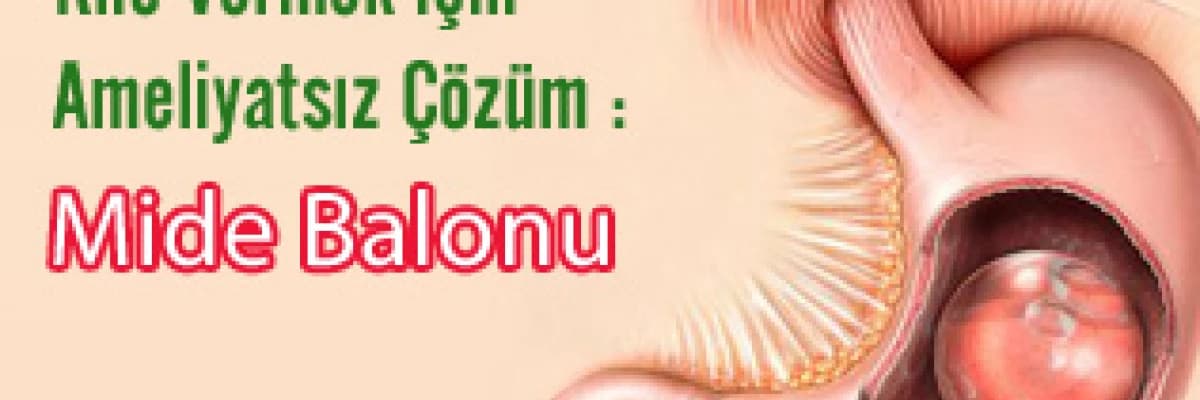 Kilo vermek için ameliyatsız çözüm: mide balonu