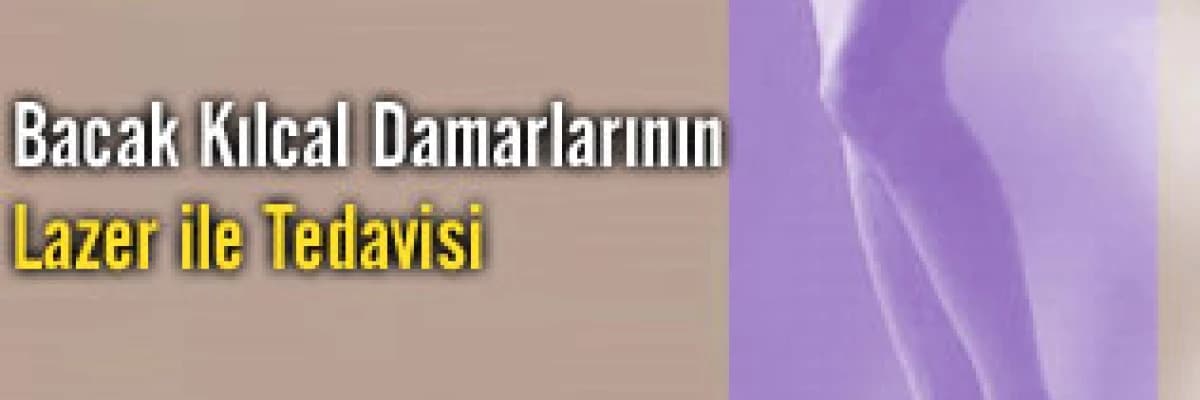 Bacak kılcal damarlarının lazer ile tedavisi