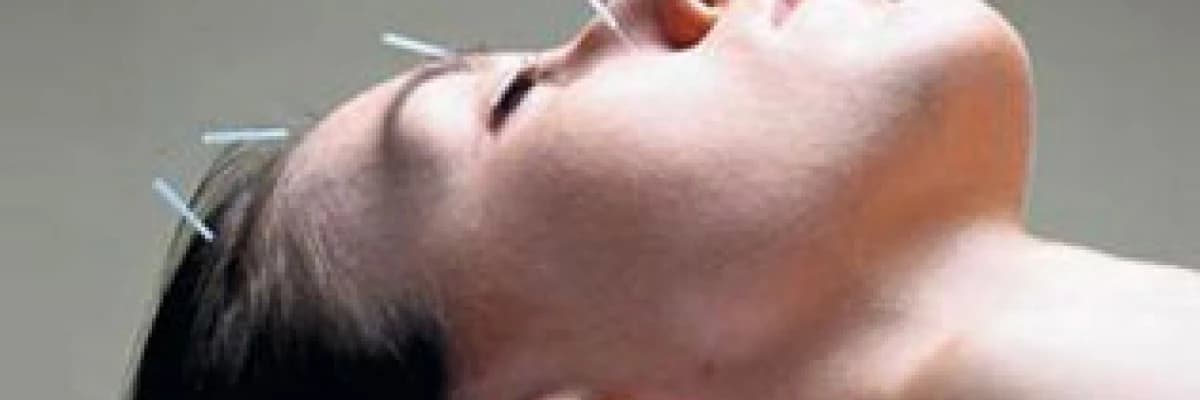 Akupunktur tedavisi neden ilaçsız bir tedavidir ?