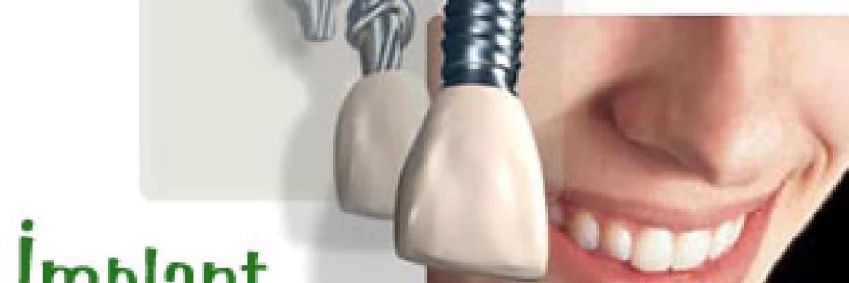 İmplant