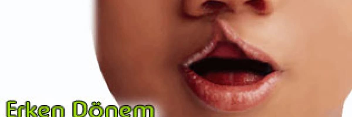 Yarık Damak Dudaklı Çocuklarda Erken Dönem Konuşma Terapisi