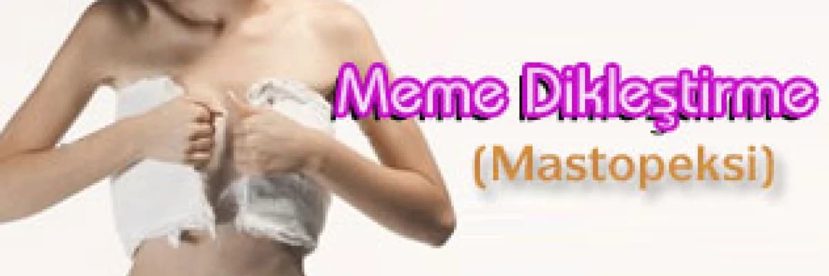 Meme dikleştirme (mastopeksi)