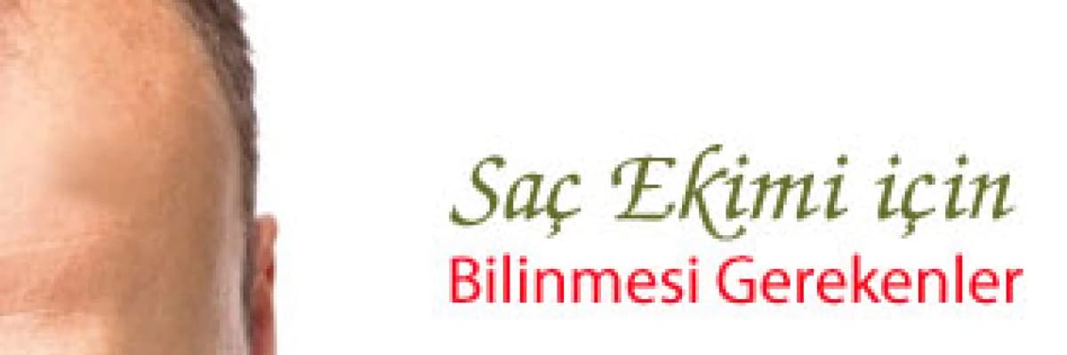 Saç ekimi için bilinmesi gerekenler