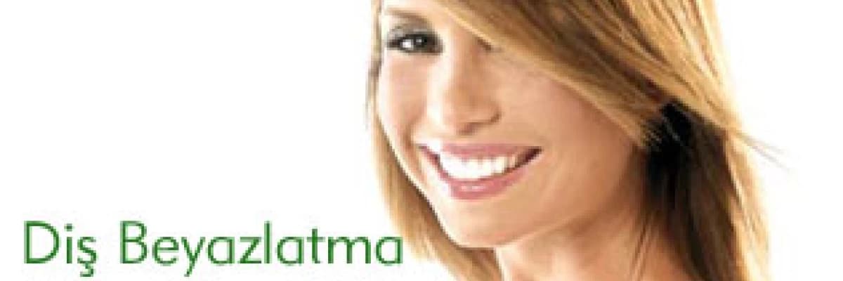 Diş beyazlatma hakkında merak edilenler