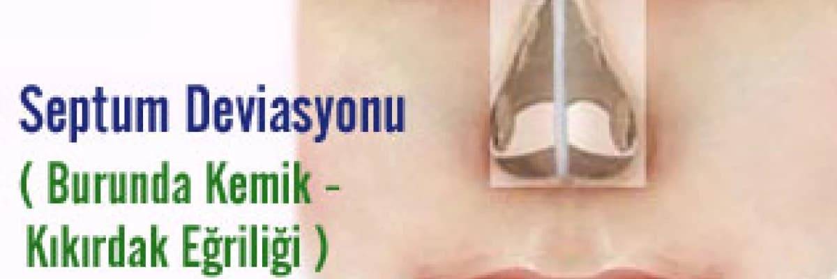 Septum Deviasyonu ( Burunda Kemik - Kıkırdak Eğriliği ) 