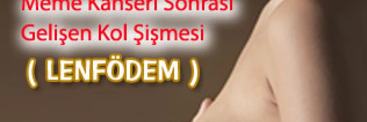 Meme Kanseri Sonrası Gelişen Kol Şişmesi ( LENFÖDEM )