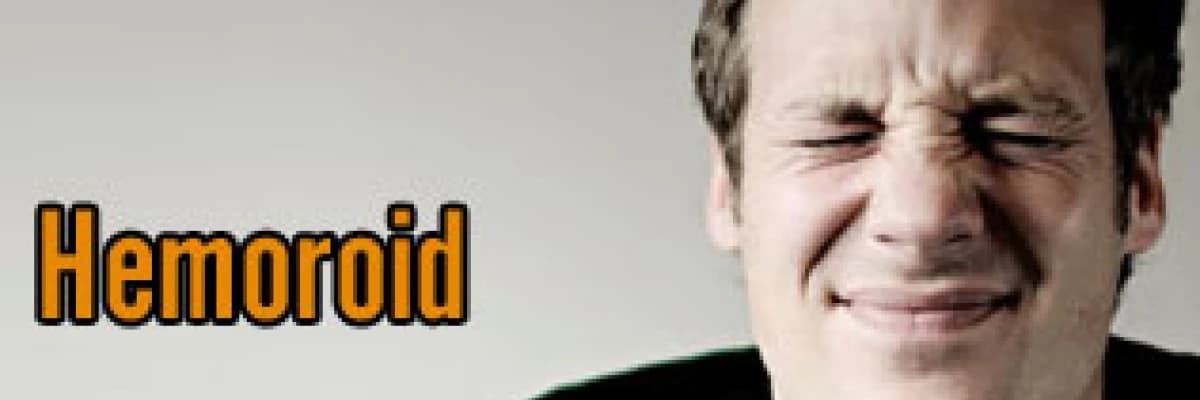 Hemoroid ve Longo yöntemiyle tedavisi