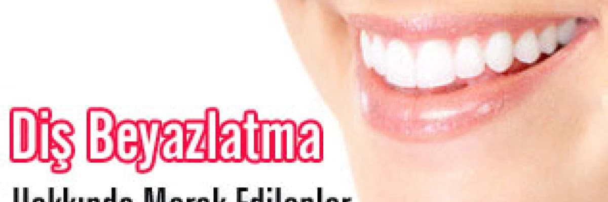 Diş Beyazlatma Hakkında Merak Edilenler