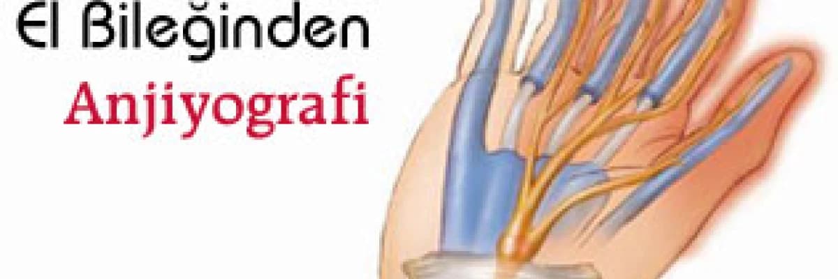 El bileğinden anjiyografi
