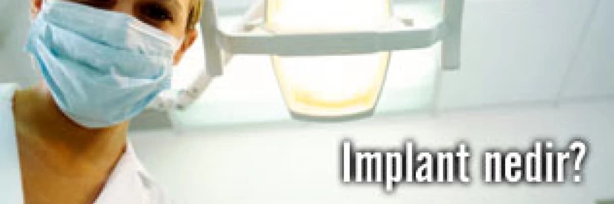 Implant hakkında merak ettikleriniz