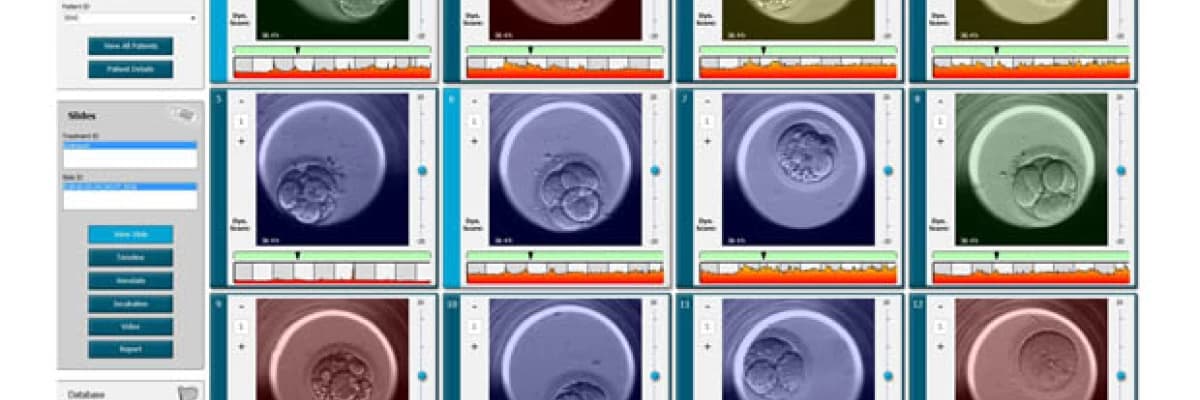 Embriyoskop  Video İle Embriyo İzleme  Embriyo Gelişiminin Sürekli İzlenmesi 