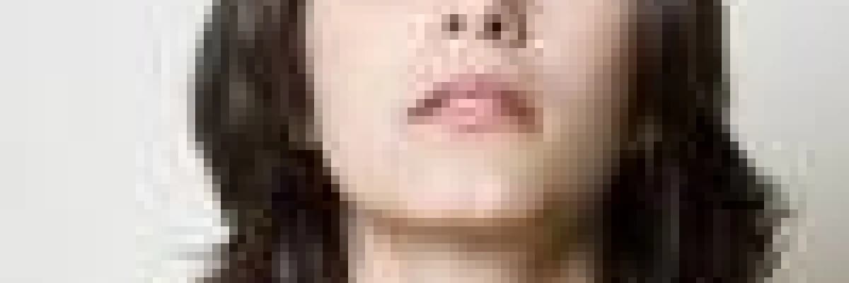 Hangi durumda Nefes Kesilmesi İçin Doktora Gitmek Gerekir? Tedavisi Nasıldır?