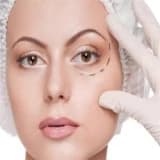 Oküloplastik cerrahi