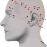 AKUPUNKTURUN TARİHÇESİ ve TÜRKİYE’DE AKUPUNKTUR