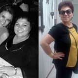 Obezite ameliyatı herkese uygun mudur?