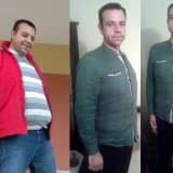 Diyabet Hastalığına  cerrahi çözüm