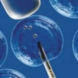 Tüp bebek ve yardımcı üreme tekniikleri