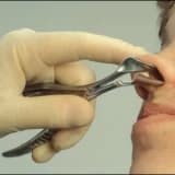 ALLERJİK RİNİTLER VE TEDAVİSİ