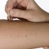 Allerji testleri hangi durumlarda ve nasıl uygulanır?