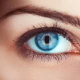 GÖZ SEĞİRMESİ NEDİR? NEDEN OLUR?