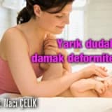 Yarık dudak ve damak deformiteleri ve tedavisi