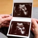 Ayrıntılı Ultrason ile bebekteki tüm hastalıkları tanımak mümkün müdür?