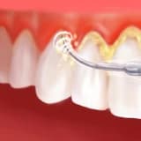 Diş Bakımı; DİŞLERİ TEMİZLETMEK ZARARLI MIDIR?