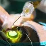 Keratokonus nedir, tedavisi nasıldır ?