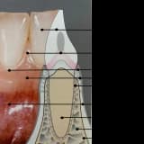 Estetik ve sağlıklı diş eti