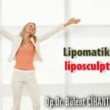 Lipomatik ile liposculpture