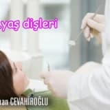 20 yaş dişi mutlaka çekilmeli midir?