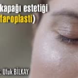 Göz kapağı estetiği (blefaroplasti)!