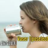 Vaser liposelection