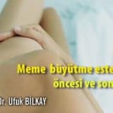Meme  büyütme estetiği öncesi ve sonrası