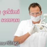 Diş çekimi ve sonrası