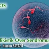 Pcos (polikistik over sendromu)