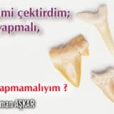 Dişimi çektirdim;ne yapmalı,ne yapmamalıyım?