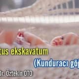 Pektus ekskavatum (kunduracı göğsü)