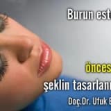 Burun estetiği öncesinde şeklin tasarlanması