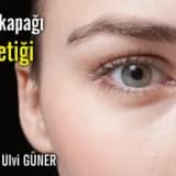 Göz kapağı estetiği