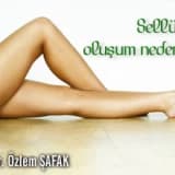 Sellülitin oluşum nedenlerini biliyormusunuz ?
