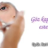 Göz kapağı  estetiği!