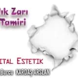 Kızlık zarı dikimi!