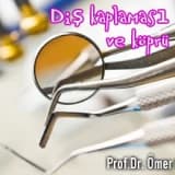 Diş kaplaması ve köprü