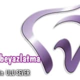 Diş beyazlatma,