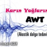 Karın yağlarında awt akustik dalga tedavisi