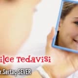 Sivilce tedavisi