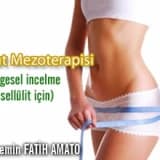 Vücut mezoterapisi ( bölgesel incelme ve sellülit için)