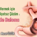Kilo vermek için ameliyatsız çözüm: mide balonu